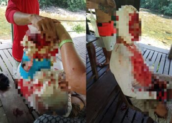 KEADAAN warga emas ketika pasukan MOCSAR memberi bantuan awal bagi menghentikan pendarahan di kepala mangsa sementara menunggu Unit Udara Bomba ke lokasi bagi menghantar mangsa ke Hospital Miri di Sarawak bagi mendapatkan rawatan lanjut.