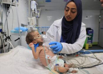 JURURAWAT Palestin merawat seorang bayi yang mengalami kekurangan zat makanan di Hospital Nasser di Khan Younis, selatan Gaza.- AFP