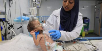 JURURAWAT Palestin merawat seorang bayi yang mengalami kekurangan zat makanan di Hospital Nasser di Khan Younis, selatan Gaza.- AFP