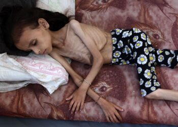 SEORANG kanak-kanak perempuan Palestin, Mariam Dawwas hanya terbaring lesu akibat kebuluran di Rimal, Gaza City. – AFP