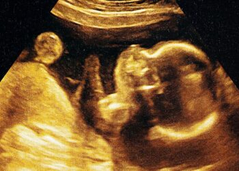 PENYELIDIK AS mendapati  penggunaan AI untuk menganalisis imbasan ultrabunyi mampu meramalkan tarikh kelahiran bayi dengan ketepatan sehingga 95 peratus. – GAMBAR HIASAN