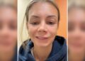 LISH Marie tular di TikTok apabila berkongsi pengalaman ngeri memicit jerawat kecil di bawah lubang hidungnya. –AGENSI