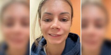 LISH Marie tular di TikTok apabila berkongsi pengalaman ngeri memicit jerawat kecil di bawah lubang hidungnya. –AGENSI