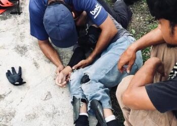 SEORANG kanak-kanak patah tulang tangan kanan selepas terjatuh ketika sedang bermain papan selaju di Taman Tuna Skate Plaza, Seberang Jaya, Pulau Pinang, kelmarin.-GAMBAR/FACEBOOK