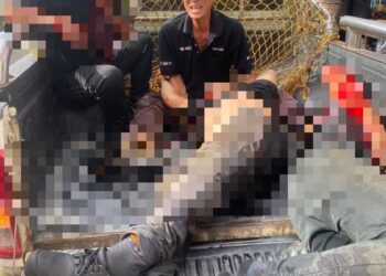 Keadaan mangsa di tempat kejadian selepas terkena serpihan enjin bot yang meletup.