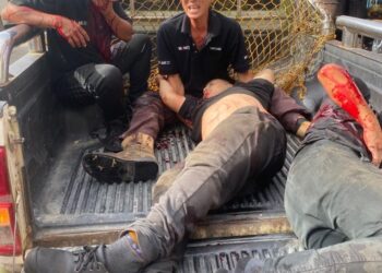 Keadaan mangsa di tempat kejadian selepas terkena serpihan enjin bot yang meletup.