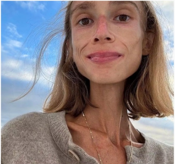 Wanita maut dalam bilik hotel akibat amal diet buah-buahan 1 05a6791a d610 448e a00a 531022a6d2ee