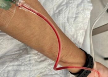 KEADAAN tangan Aina dengan kesan kelar, sewaktu dibawa ke hospital untuk menerima rawatan.