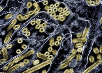 KES  terbaharu selsema burung di Washington menunjukkan penularan pertama dalam kalangan manusia.-AFP