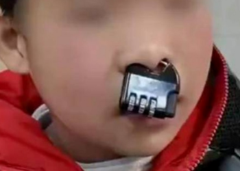 TANGKAP layar video tular mangga kunci tersangkut pada hidung seorang kanak-kanak di Huaihua di wilayah Hunan, China.-AGENSI