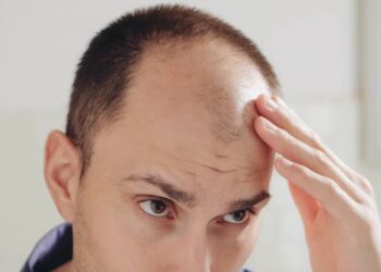 GOLONGAN lelaki cederung mengalami kebotakan rambut manakala wanita hanya mengalami penipisan rambut.