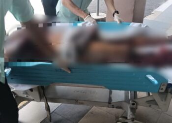 SEORANG mekanik dibawa ke hospital selepas berlaku letupan berpunca daripada kebocoran gas pendingin hawa ketika mangsa sedang membaiki sebuah kenderaan.