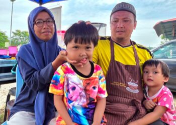 MOHD. Rizal Abdul Aziz menunjukkan ketumbuhan pada pipi kanan Nurul Naila Zara ketika ditemui di Kampung Gajah, Pasir Salak, Perak.