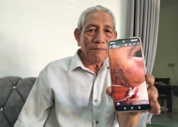 ABDUL Kadir Mohamad menunjukkan gambar kecederaan yang dialami anaknya selepas terkena tembakan rambang pencuri lembu di Ladang Kemahang 1, Tanah Merah, Kelantan.