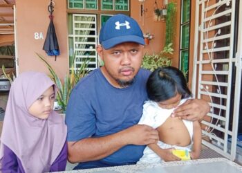 MOHAMAD Syafiq Ayob menunjukkan kesan pembedahan membuang hempedu di perut anaknya, Nursyafia Ayra semasa ditemui di Kampung Paya Kerchut, Tikam Batu di Sungai Petani, Kedah.