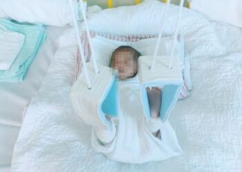 KEADAAN bayi lelaki didakwa patah tulang paha ketika menerima rawatan penyakit jaundis di sebuah hospital di Sungai Petani. – IHSAN BAPA MANGSA