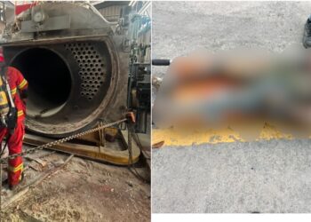 Pekerja maut melecur