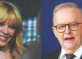 ANTHONY ALBANESE (kanan) dan Kylie Minogue.- AFP