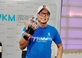 RJ Nagarajan menunjukkan prostesis tangan yang digunakan.