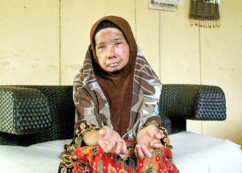 :ENDOTEK Ambok menunjukkan keadaan jarinya yang bengkok akibat penyakit scleroderma ketika ditemui di Kampung Ulu Air Kuning Selatan, Gemencheh, Tampin, semalam.- UTUSAN/ NOR SHAFIQAH MOHD. GHAZALI