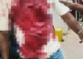 LELAKI cedera ditembak dua lelaki bersenjata api dalam kejadian di sebuah stesen minyak di Bidor Sentral, Bidor semalam.