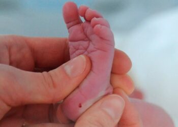 SAMPEL darah digunakan untuk menjalankan saringan bayi baru dilahirkan bagi merawat beberapa keadaan sejak dahulu lagi. - AGENSI  