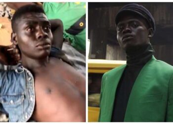 KEADAAN Ali Olakunmi sebelum dan selepas mendapat tawaran menjadi model untuk penggambaran fesyen. - AGENSI 