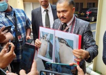 PEGUAM keluarga Nofriansyah, Kamaruddian Simajuntak menunjukkan gambar badan jenazah yang dipenuhi luka selain kesan tembakan. - AGENSI