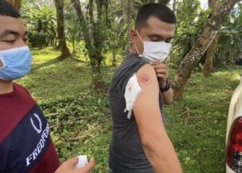 PEGAWAI polis Mueang Krabi menunjukkan kesan luka akibat digigit suspek yang mencuri kabel di wilayah Krabi kelmarin.-AGENSI