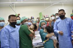 Kembar Siam Berusia Tiga Tahun Berjaya Dipisahkan Di Manado