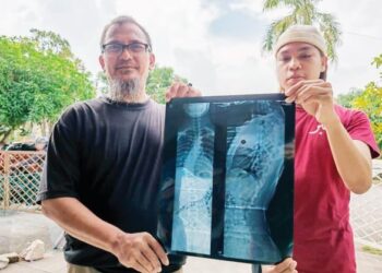 ADZMARUDIN Abd. Rahman (kiri) bersama anaknya, Ahmad Darwisy Farhan yang menghidap penyakit skoliosis atau tulang belakang bengkok ketika ditemui di Seremban 2, Seremban. – UTUSAN/NOR SHAFAWATI YUP