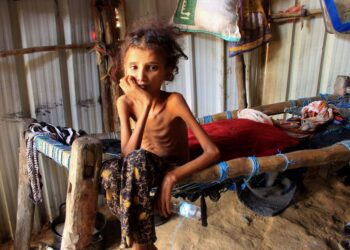 KANAK-kanak Yemen, 10 tahun Ahmadia Abdo yang mempunyai berat sepuluh kilogram akibat kekurangan zat makanan akut, duduk di atas katilnya di sebuah kem untuk pelarian dalaman di utara Gabenor Hajjah, Yemen. -AFP