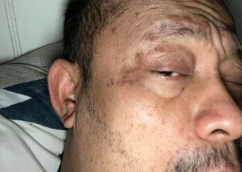 HANTARAN di Facebook menunjukkan 'penyakit misteri' dialami Kazim Elias.