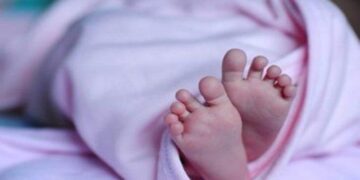 BAYI baru lahir terpaksa menjalani pembedahan membuang janin yang dikesan dalam perutnya di Hospital Besar WZ Johannes Kupang minggu lalu.-AGENSI