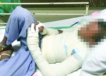 KEADAAN remaja yang cedera selepas dibakar rakannya di Hospital Tengku Ampuan Afzan, Kuantan, Pahang.