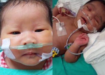 SENG ZI TONG dan P. Darsinidevi antara dua daripada tiga kanak-kanak yang memerlukan dana RM225,000 untuk menjalani pembedahan jantung dengan segera.