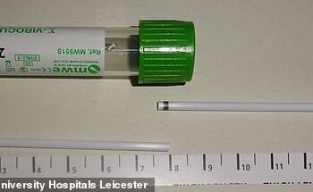 KIT ujian Covid-19 terpatah dan tersekat dalam paru-paru seorang wanita di hospital di Leicester, Britain. - AGENSI
