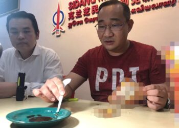 Ooi (kanan) menunjukkan serpihan dipercayai kaca dalam mi segera yang menyebabkan  gusinya luka  manakala anaknya luka pada lidah ketika ditemui di Kampar semalam. – UTUSAN/LIYANA RAMLI