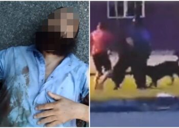 SALAH seorang mangsa serangan anjing di Taman Desa Bidara, Kuala Ketil di Baling.