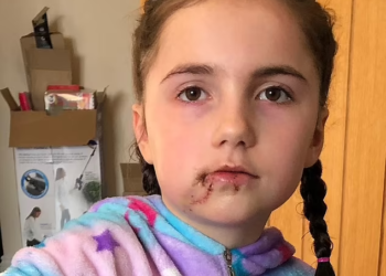 MANGSA serangan anjing di Britain. -AGENSI