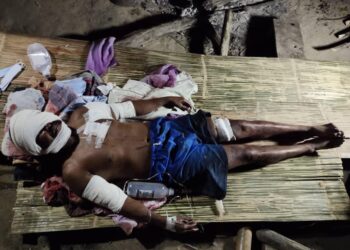 ADIN Andok cedera parah akibat dicakar harimau belang di Kampung Badak, Pos Bihai, Gua Musang, Kelantan, semalam.