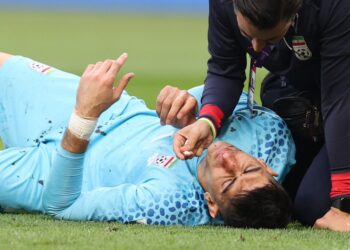 HIDUNG Alireza Beiranvand berdarah selepas berlanggar dengan rakan sepasukan dalam aksi Kumpulan B, Piala Dunia 2022 menentang England. - AFP