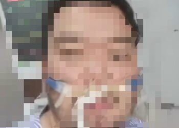 JKNPP mengesahkan pesakit Covid-19 yang mendakwa dirinya diculik dan dipaksa menjalani rawatan di ICU Hospital Pulau Pinang masih menjalani rawatan di ICU kerana keadaannya yang kritikal.