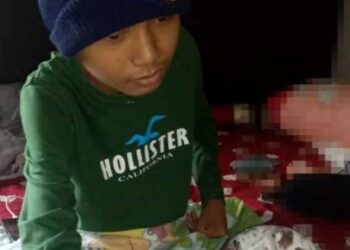 Mohamad Hafaz Ali Mohd Nazri yang mengidap kanser tulang kaki kiri kini terlantar di rumahnya di Kampung Tembak B, Kuala Ketil, baru-baru ini