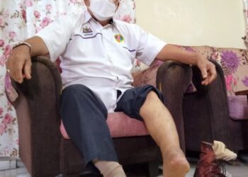 HUSSIN Mahbeb menunjukkan pergelangan kaki kirinya yang putus selepas terpijak jerangkap samar di kediamannya di Sungai Udang, Melaka. - UTUSAN/MUHAMMAD SHAHIZAM TAZALI