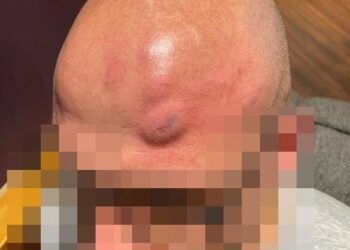 MANGSA cedera dipukul sebelum tayangan filem James Bond terbaharu, No Time to Die. - MEN MEDIA