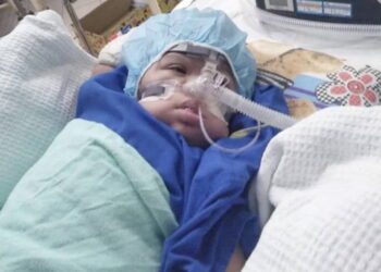 MOHD. Iskandar Mohamad Syaimi yang berusia setahun memerlukan dana sehingga RM90,000 untuk pembedahan berkaitan jantung yang dideritainya sejak lahir.