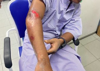 ANGGOTA Unit Rondaan Bermotosikal (URB), Konstabel Muhammad Aiman Nordin yang cedera selepas motosikalnya terbabas ditendang mat rempit dalam kejadian di Kampung Tanjung Berembang, Nibong Tebal, Pulau Pinang awal pagi tadi.
Pic IHSAN PDRM