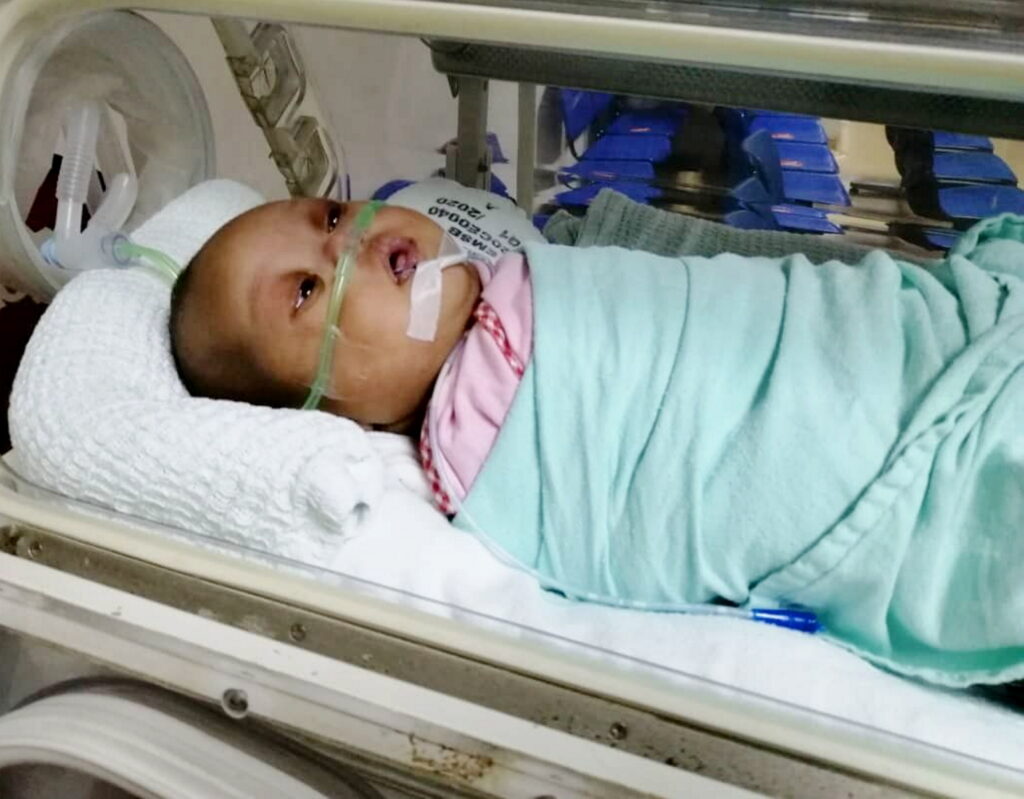 Bayi hidap masalah jantung perlu bantuan Bayi hidap masalah jantung perlu bantuan