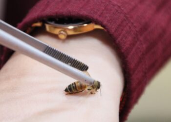 KAEDAH rawatan adalah dengan membiarkan lebah menyengat pada bahagian anggota badan yang sakit. Tunggu beberapa minit bagi membolehkan bisa serangga itu menyerap ke saluran darah.